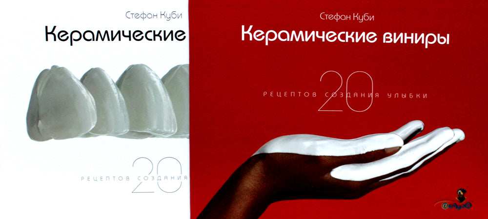 Керамические виниры