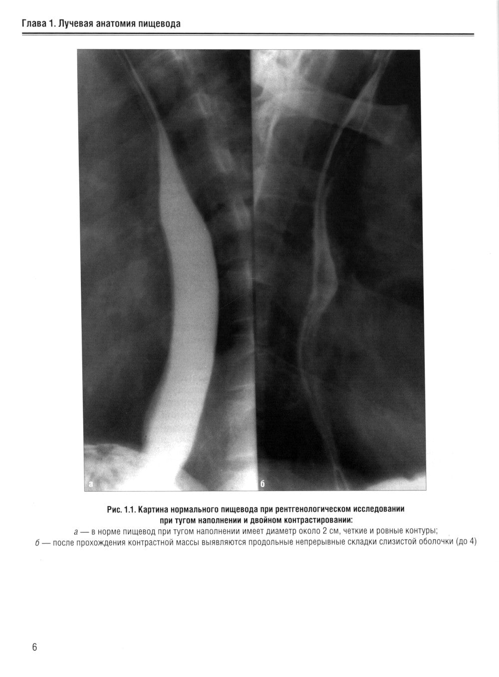 Визуализация заболеваний желудочно-кишечного тракта: Учебное пособие