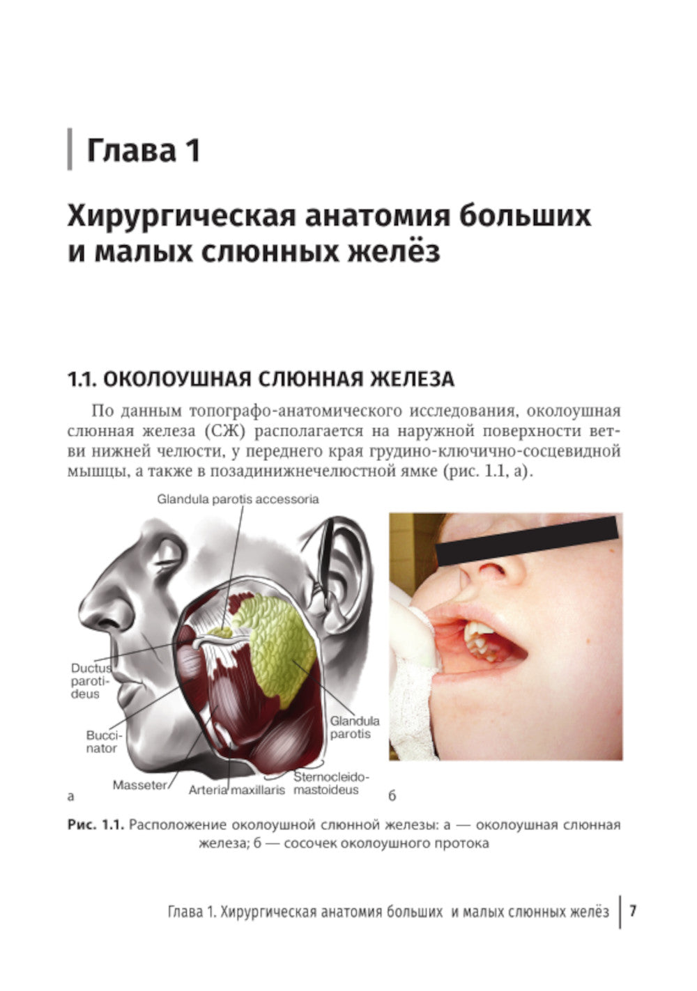 Слюннокаменная болезнь - сиалолитиаз: руководство для врачей