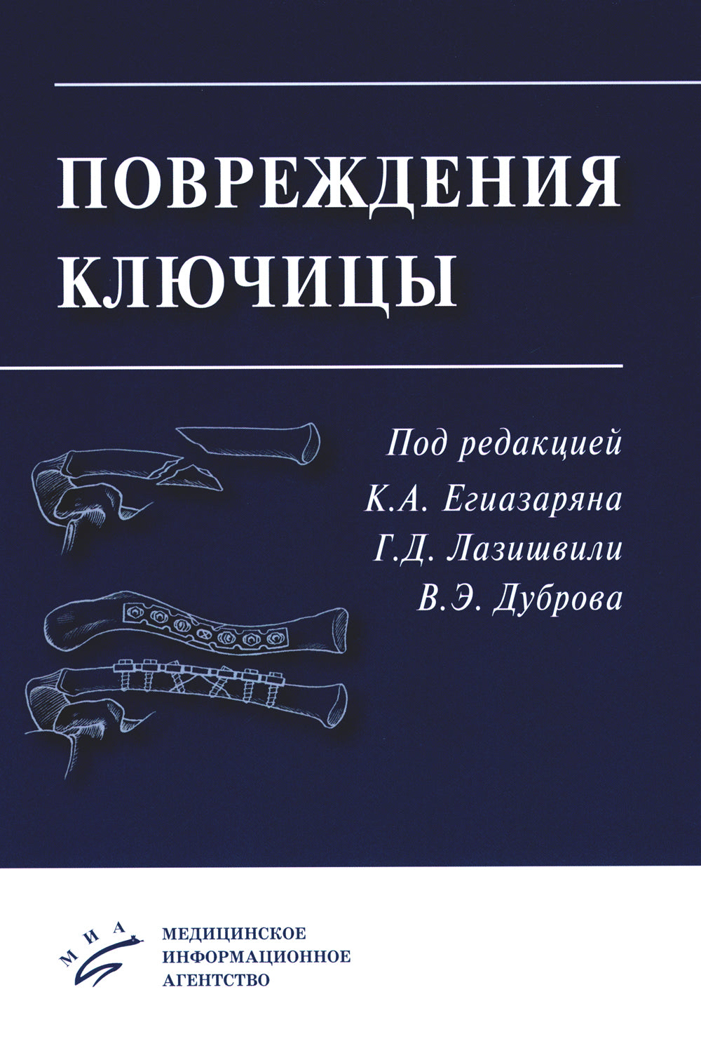 Clés d'activation : Fonctionnement simple