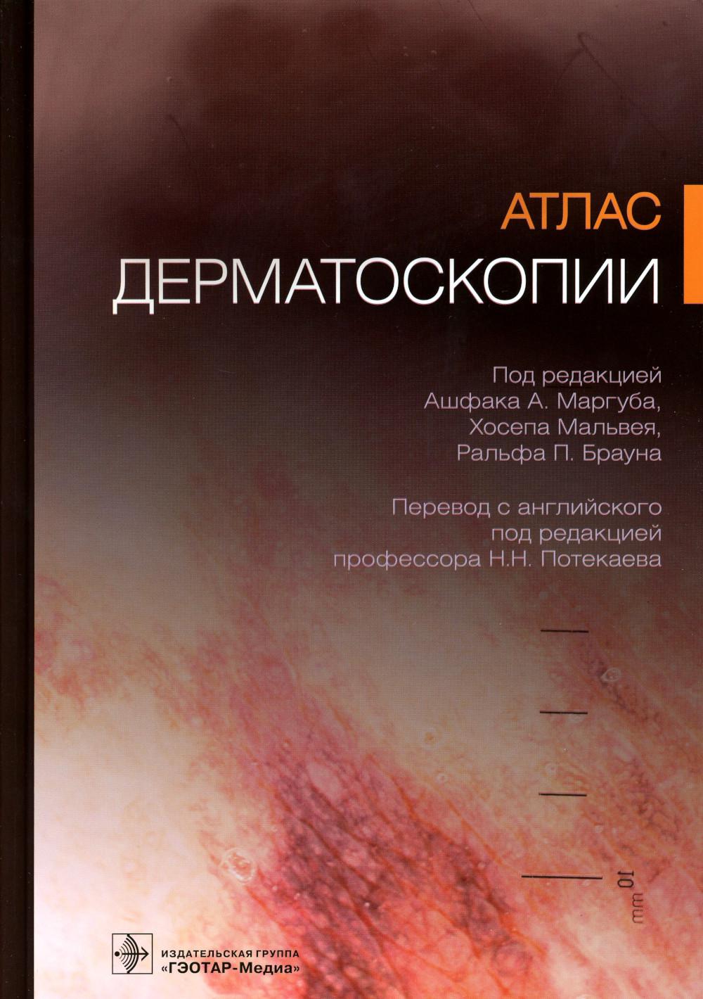 Атлас дерматоскопии