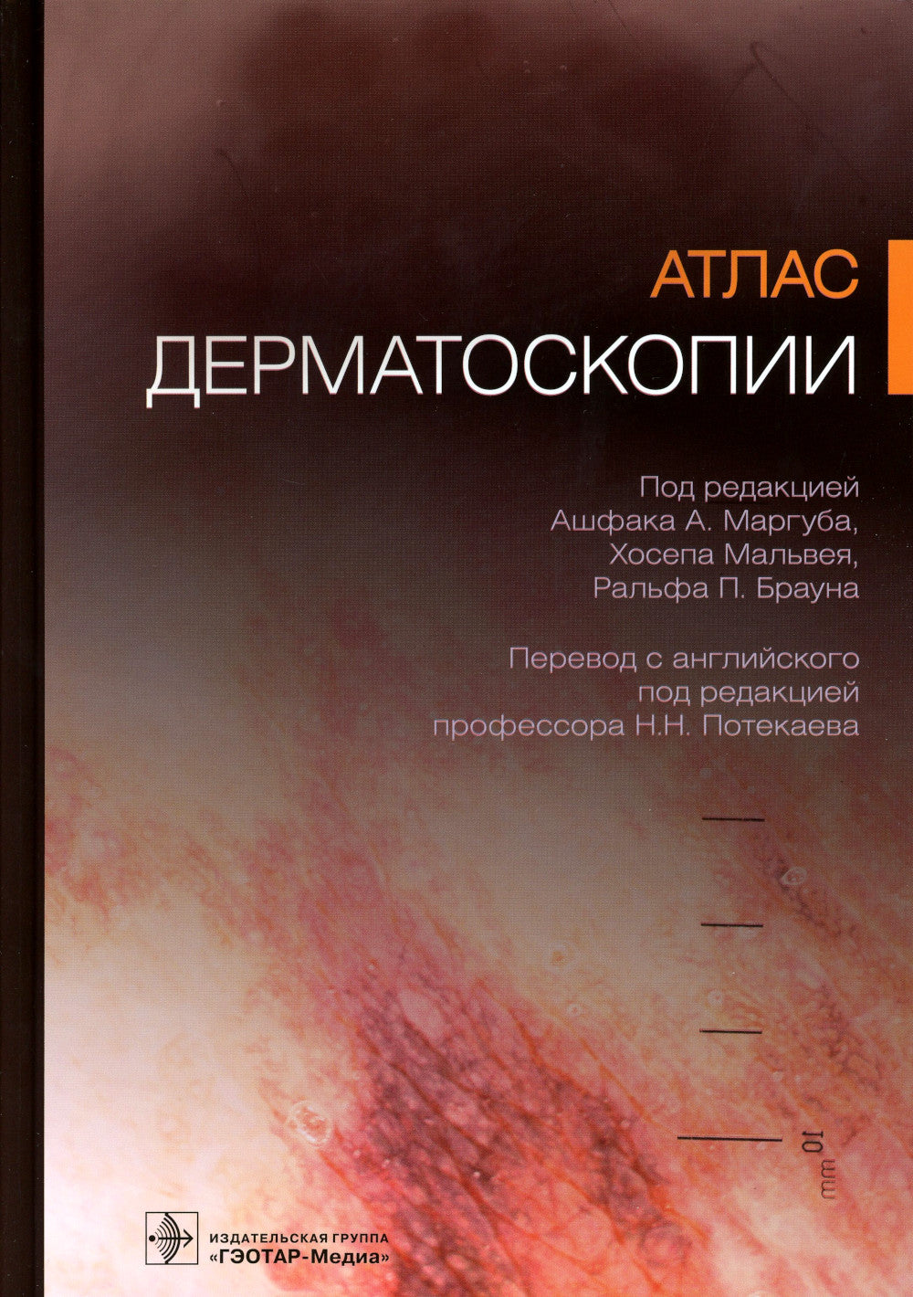 Атлас дерматоскопии