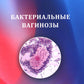 Бактериальные вагинозы