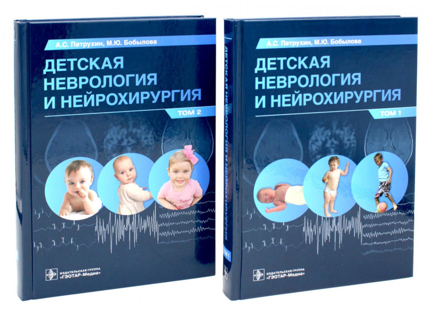 Детская неврология и нейрохирургия: Учебник: В 2-х т (комплект)