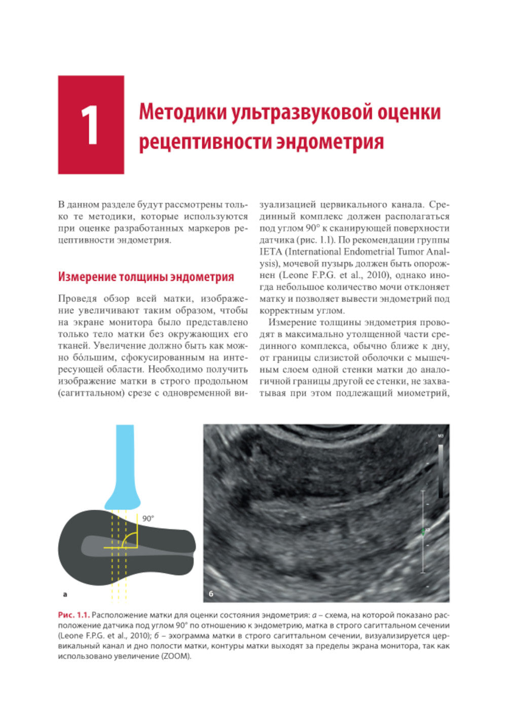 Ультразвуковая оценка рецептивности эндометрия: методические рекомендации