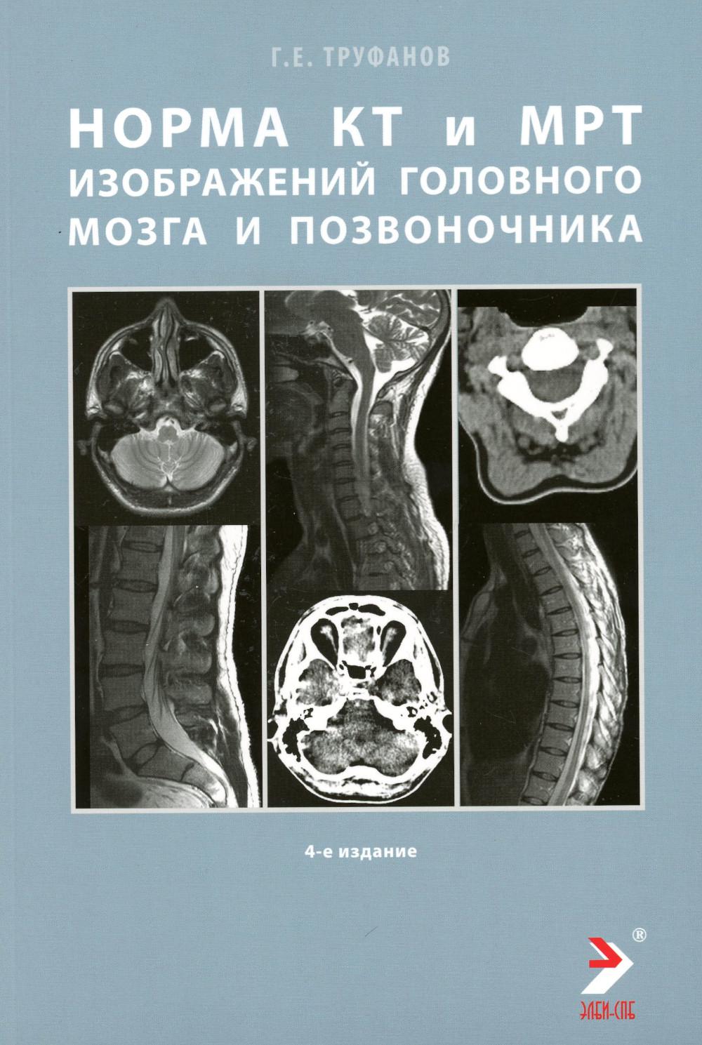 Les normes КТ- и МРТ- изображений головного мозга и позвоночника: atlas изображений. 4-ème jour