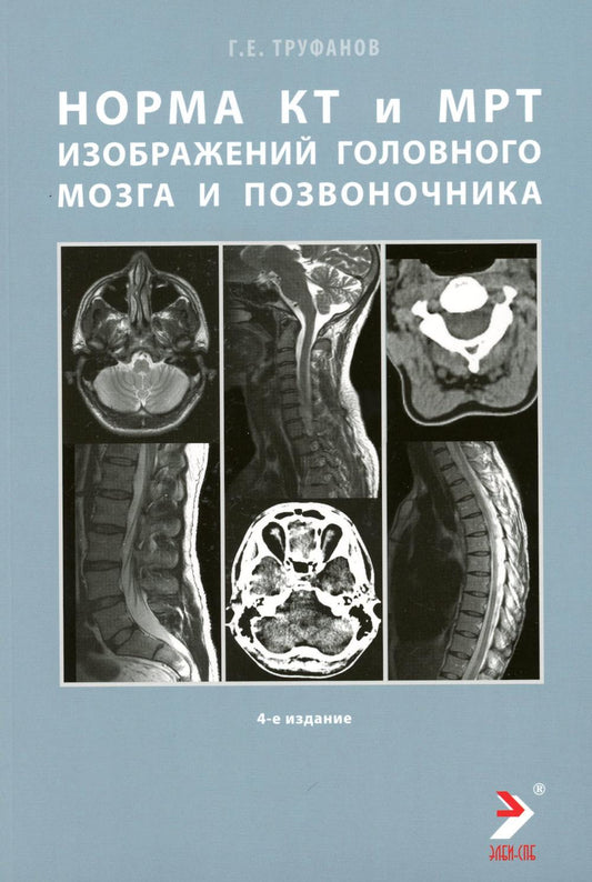 Les normes КТ- и МРТ- изображений головного мозга и позвоночника: atlas изображений. 4-ème jour