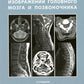 Les normes КТ- и МРТ- изображений головного мозга и позвоночника: atlas изображений. 4-ème jour