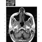 Les normes КТ- и МРТ- изображений головного мозга и позвоночника: atlas изображений. 4-ème jour