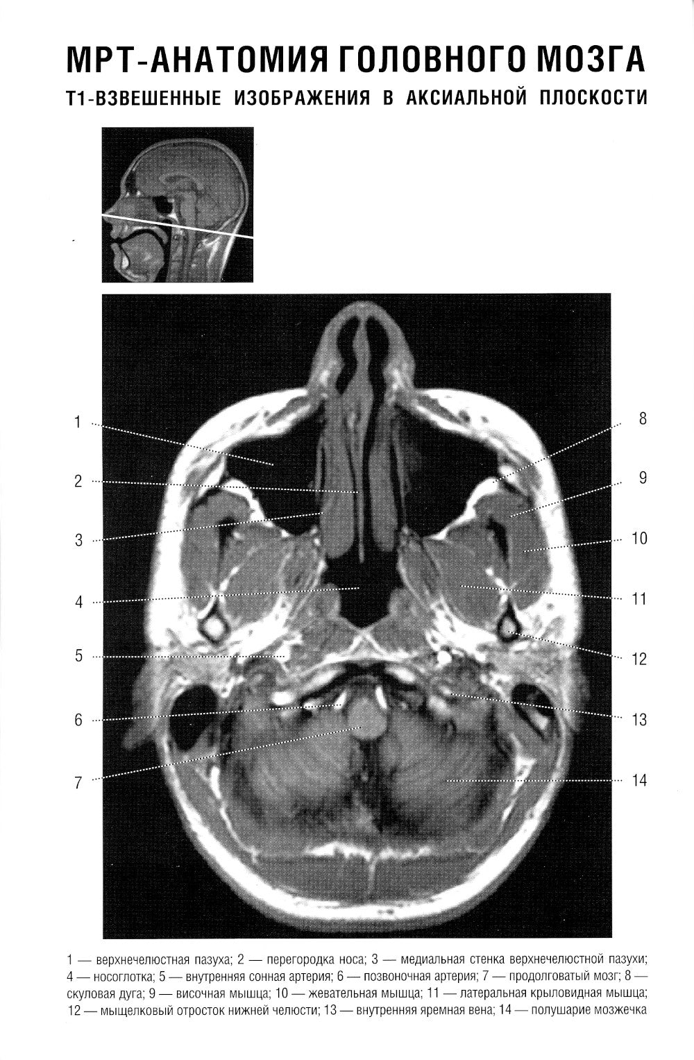 Les normes КТ- и МРТ- изображений головного мозга и позвоночника: atlas изображений. 4-ème jour