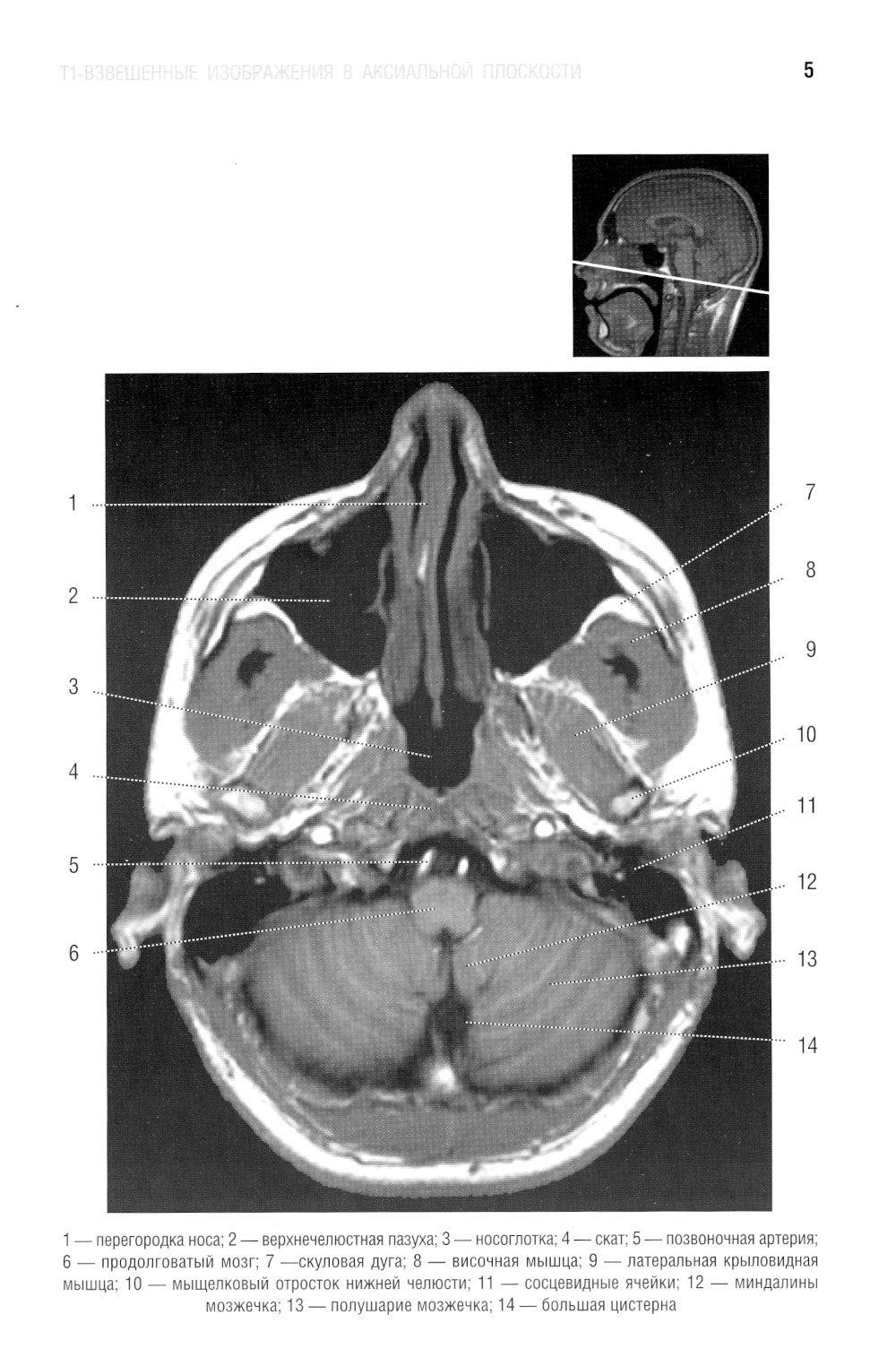 Les normes КТ- и МРТ- изображений головного мозга и позвоночника: atlas изображений. 4-ème jour