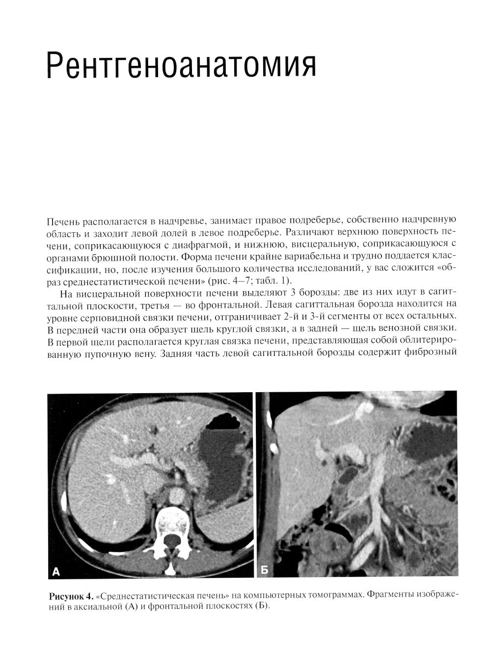Компьютерная томография печени и желчевыводящих путей: практическое руководство.