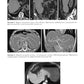Компьютерная томография печени и желчевыводящих путей: практическое руководство.