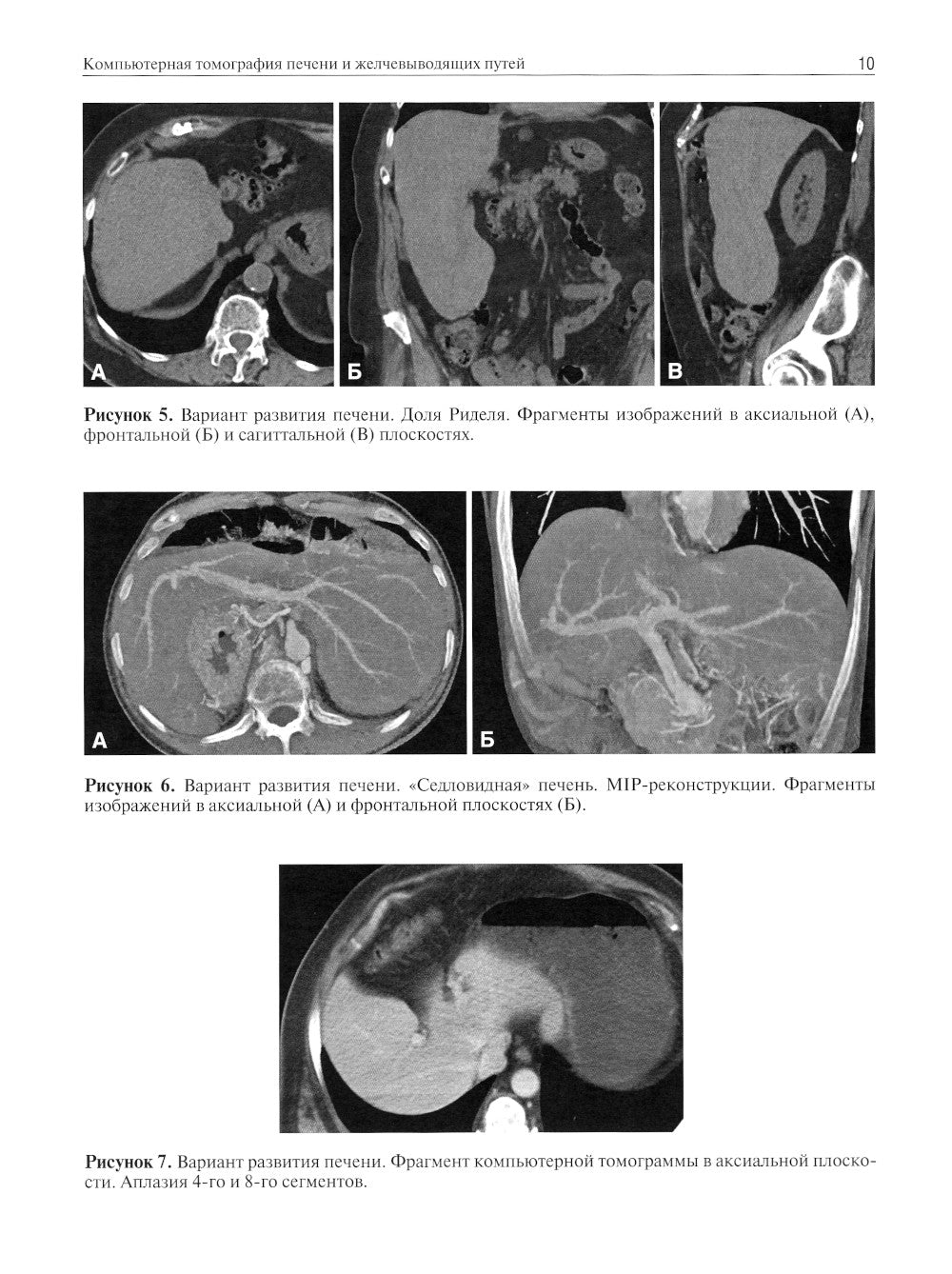 Компьютерная томография печени и желчевыводящих путей: практическое руководство.