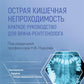 Острая кишечная непроходимость. Краткое руководство для врача-рентгенолога