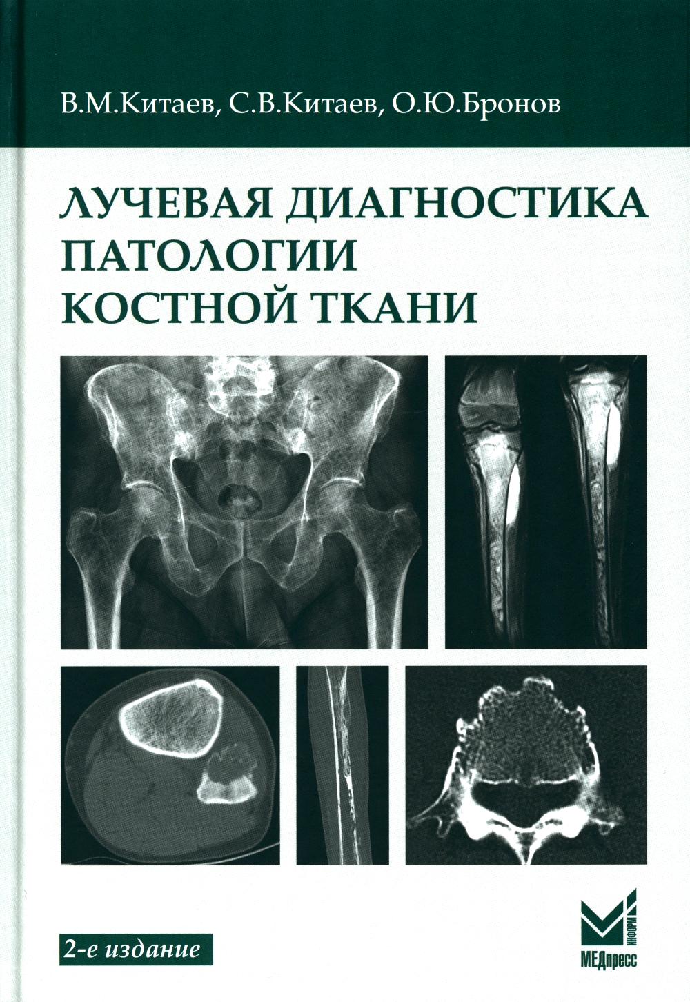 Лучевая диагностика патологии костной ткани. 2-e jour