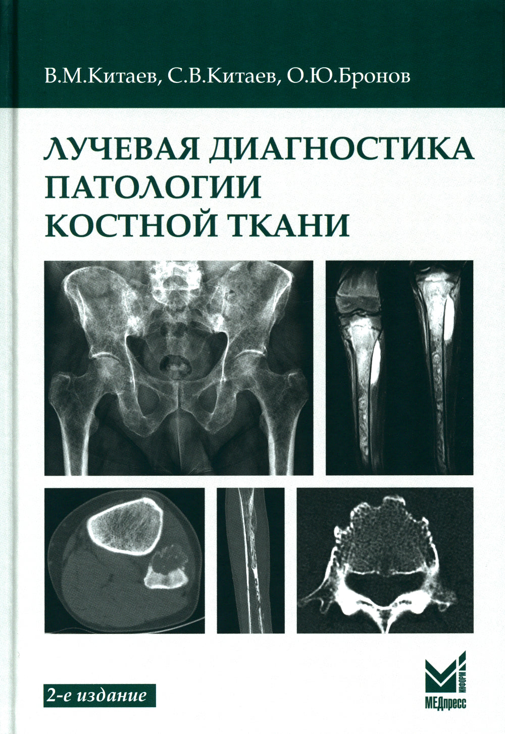 Лучевая диагностика патологии костной ткани. 2-e jour