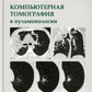 Компьютерная томография в пульмонологии. 4-е изд