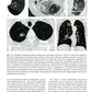 Компьютерная томография в пульмонологии. 4-е изд