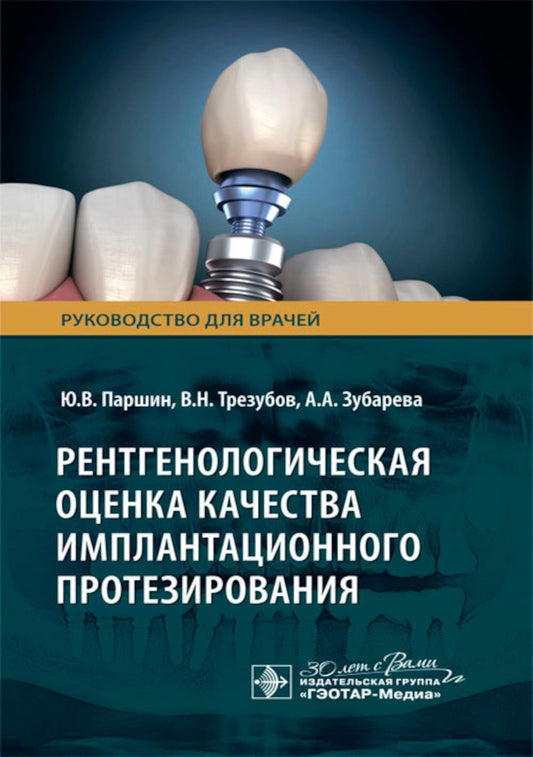 Рентгенологическая оценка качества имплантационного протезирования: руководство для врачей