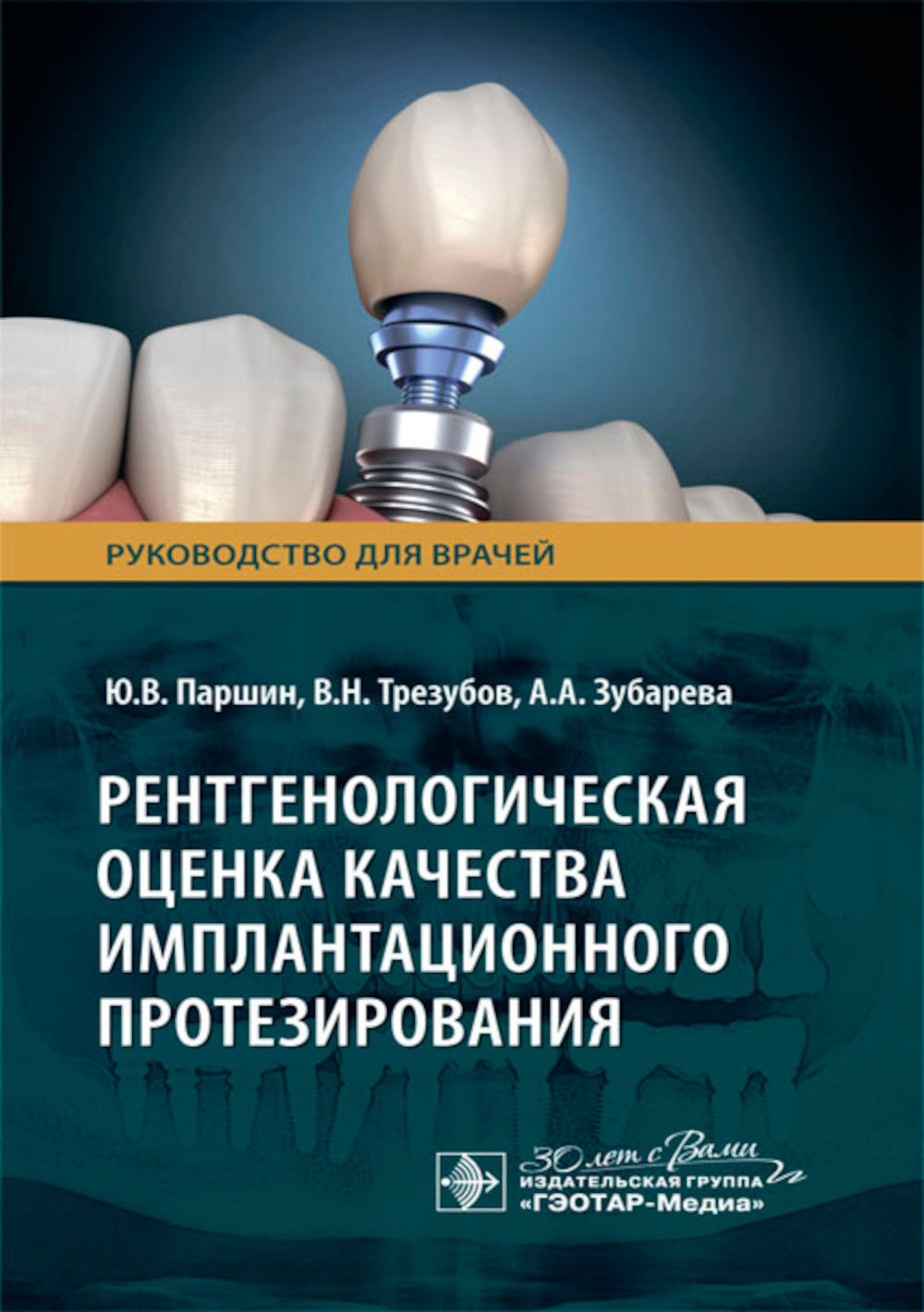 Рентгенологическая оценка качества имплантационного протезирования: руководство для врачей