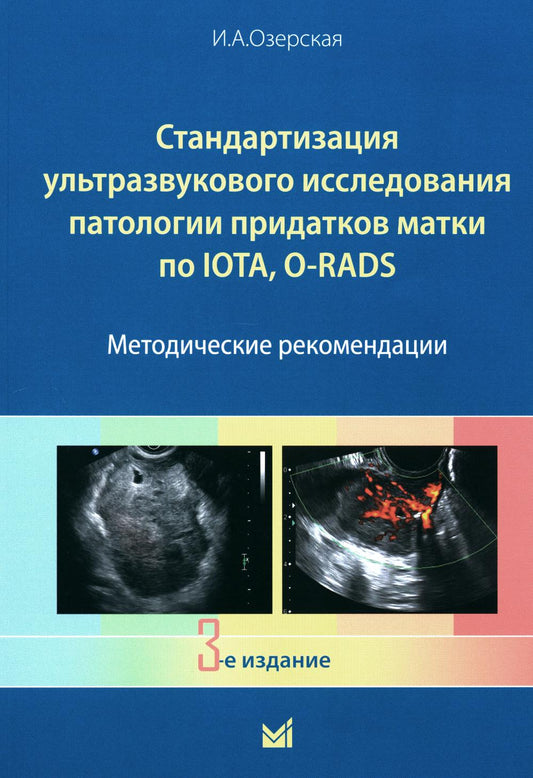 Стандартизация ультразвукового исследования придатков матки по IOTA, O-RADS. Методические рекомендации. 3-е изд., доп.