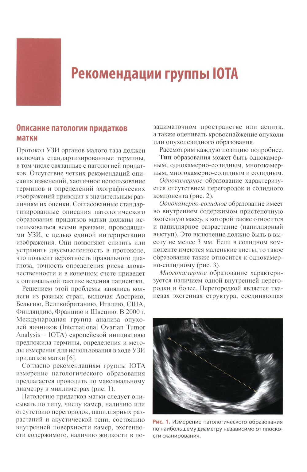 Стандартизация ультразвукового исследования придатков матки по IOTA, O-RADS. Методические рекомендации. 3-е изд., доп.