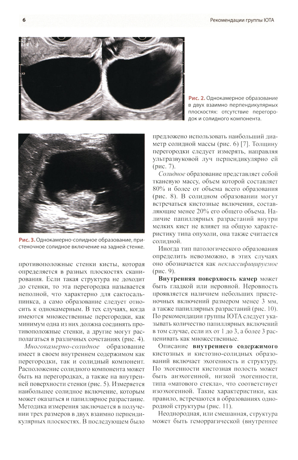 Стандартизация ультразвукового исследования придатков матки по IOTA, O-RADS. Методические рекомендации. 3-е изд., доп.