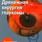 Дренажная хирургия глаукомы: руководство для врачей