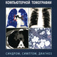 Включение в торакальную компьютерную томографию. Симптом, синдром, диагноз. 2-е изд