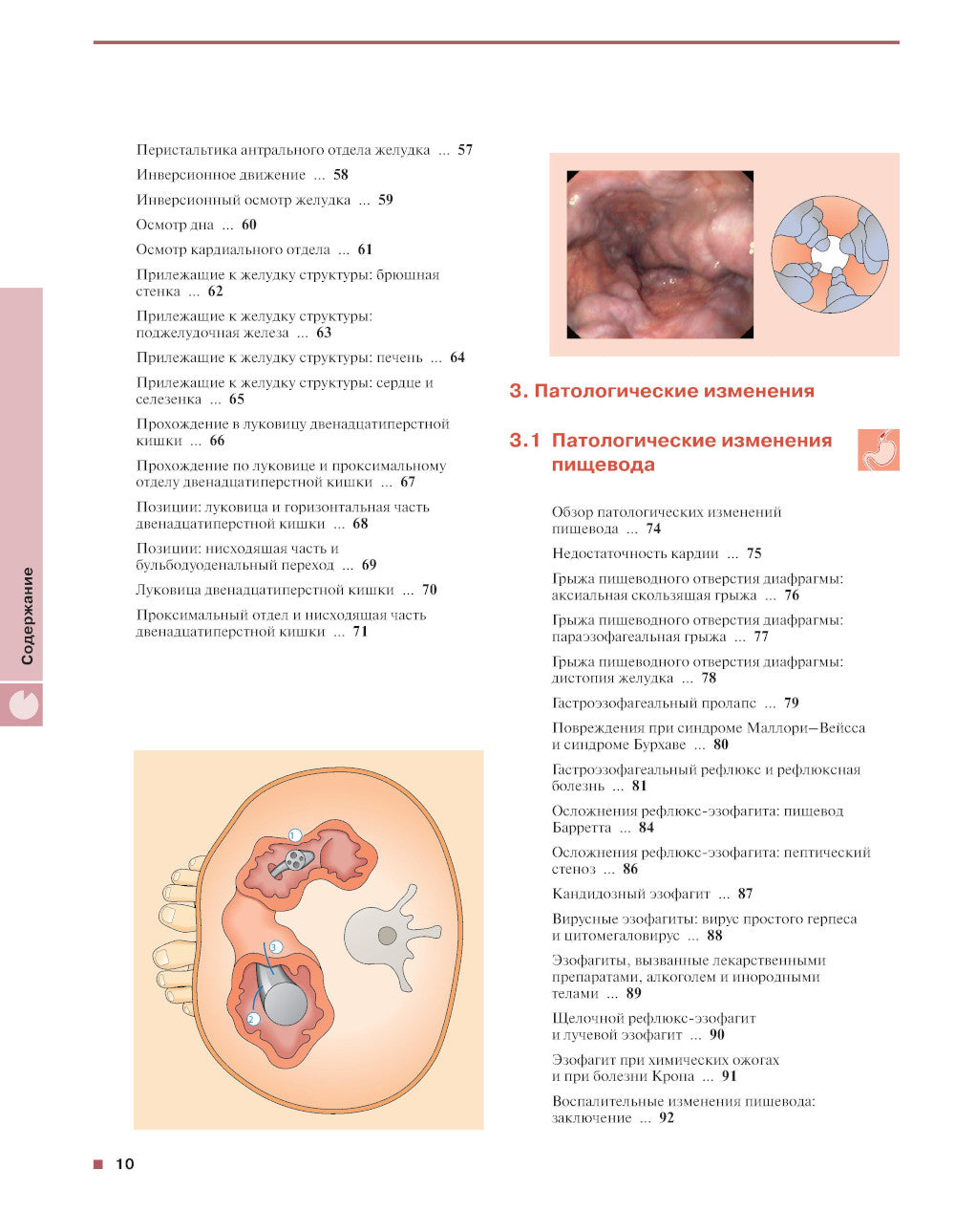 Gastroscopie. 5-ème jour