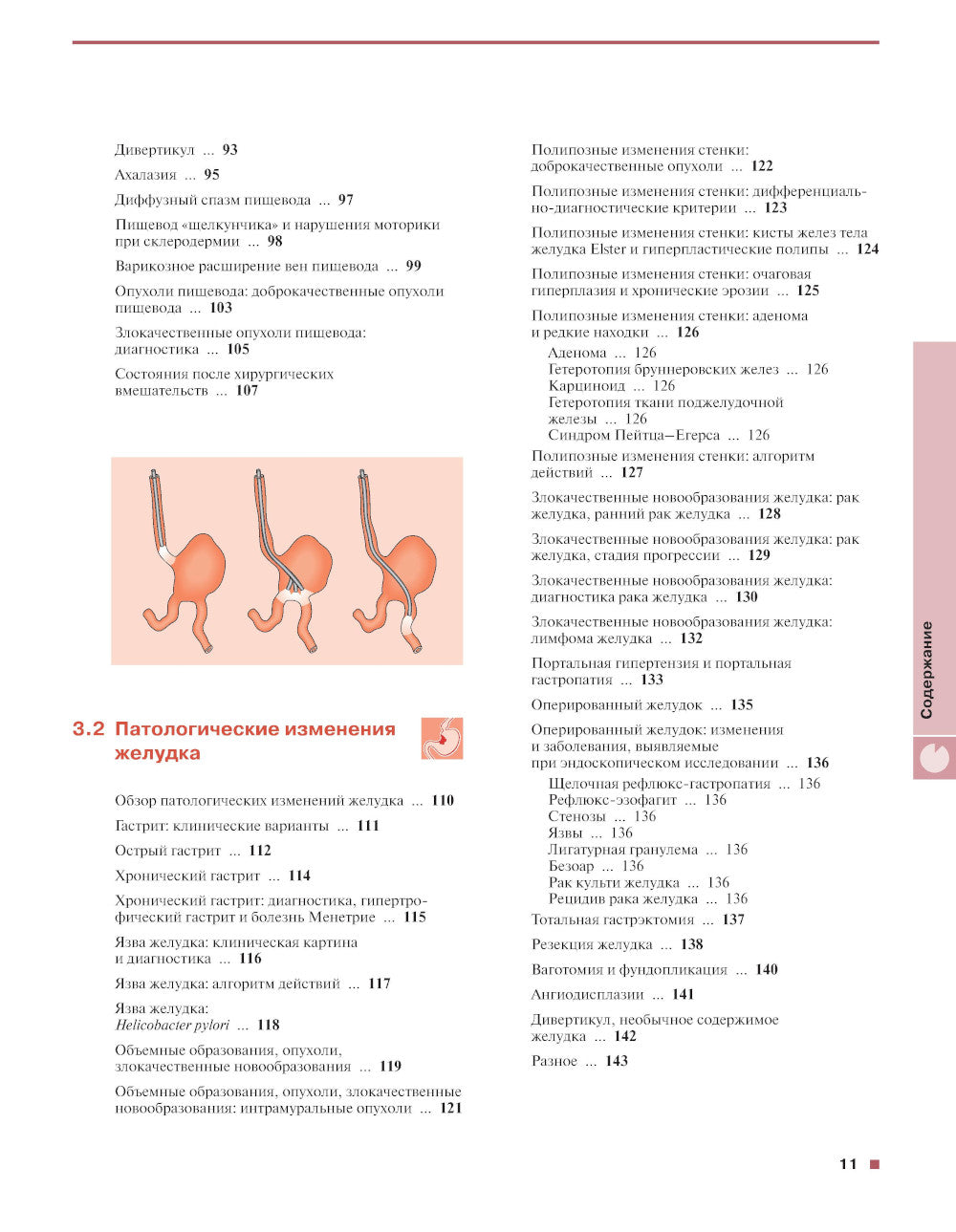 Gastroscopie. 5-ème jour