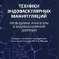 Техники эндоваскулярных манипуляций. Проводники и катетеры в эндоваскулярной хирургии