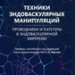 Техники эндоваскулярных манипуляций. Проводники и катетеры в эндоваскулярной хирургии