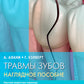 Травмы зубов. Наглядное пособие