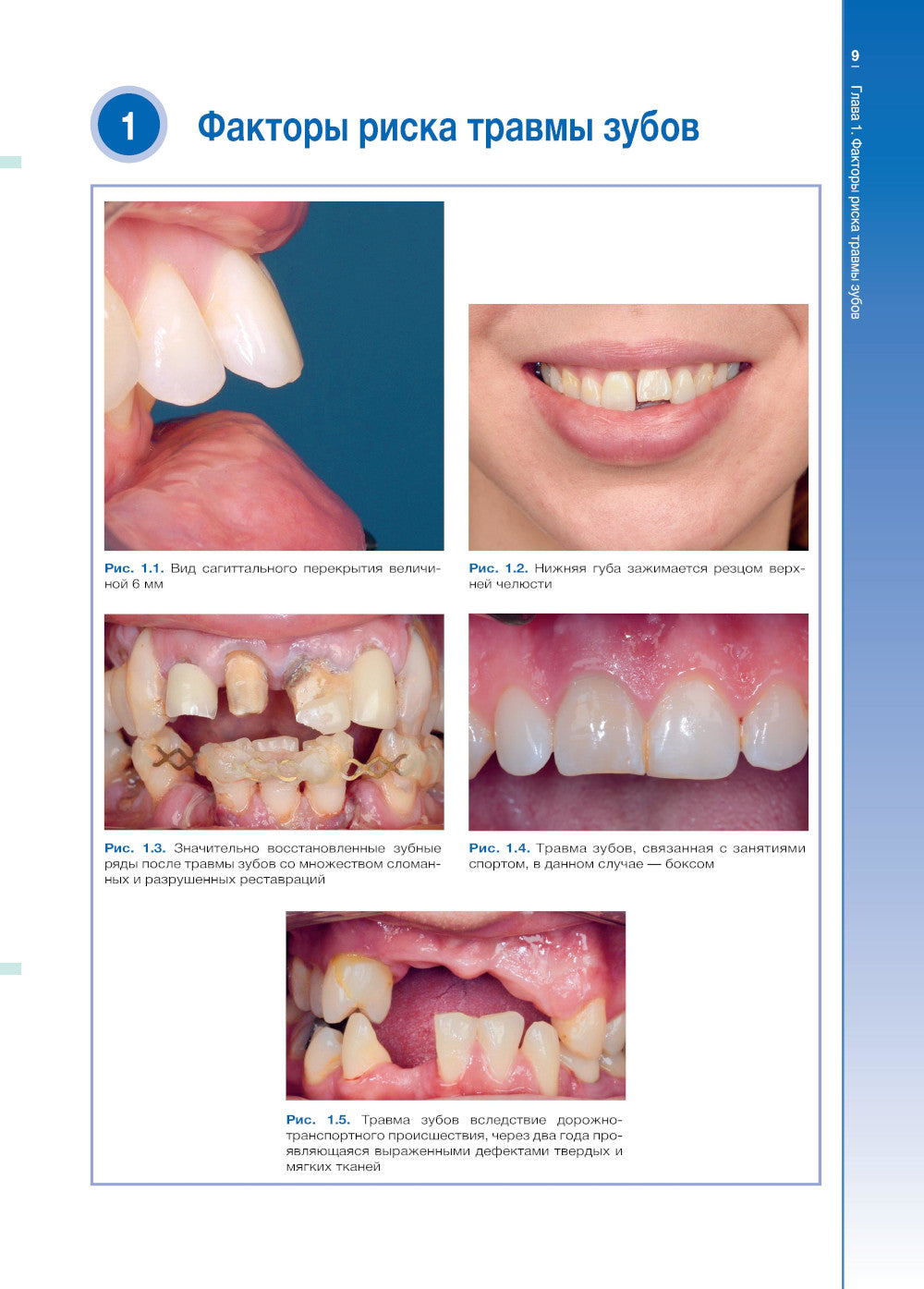 Травмы зубов. Наглядное пособие