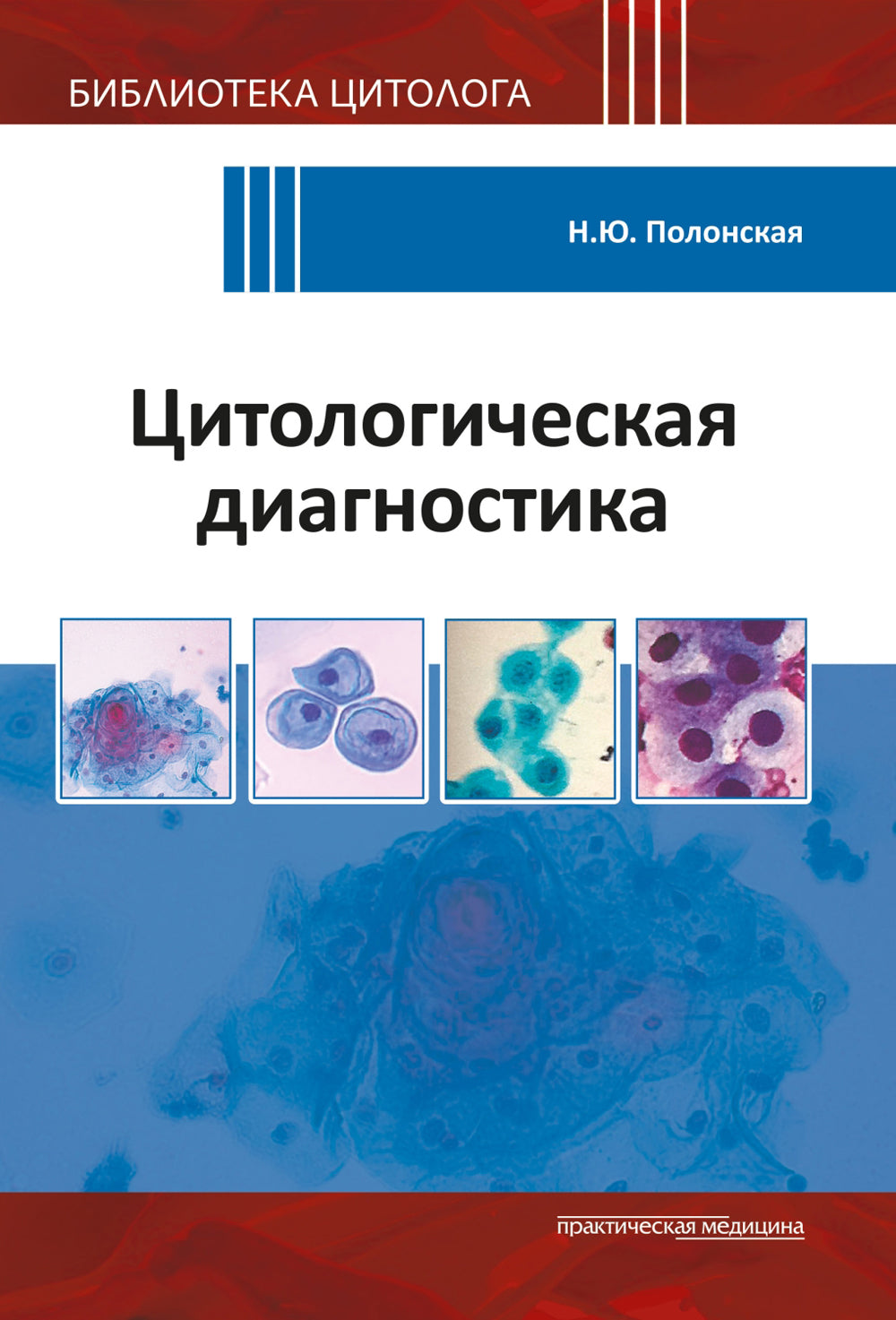 Diagnostic cytologique