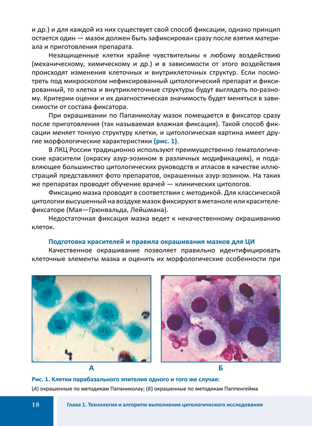 Diagnostic cytologique