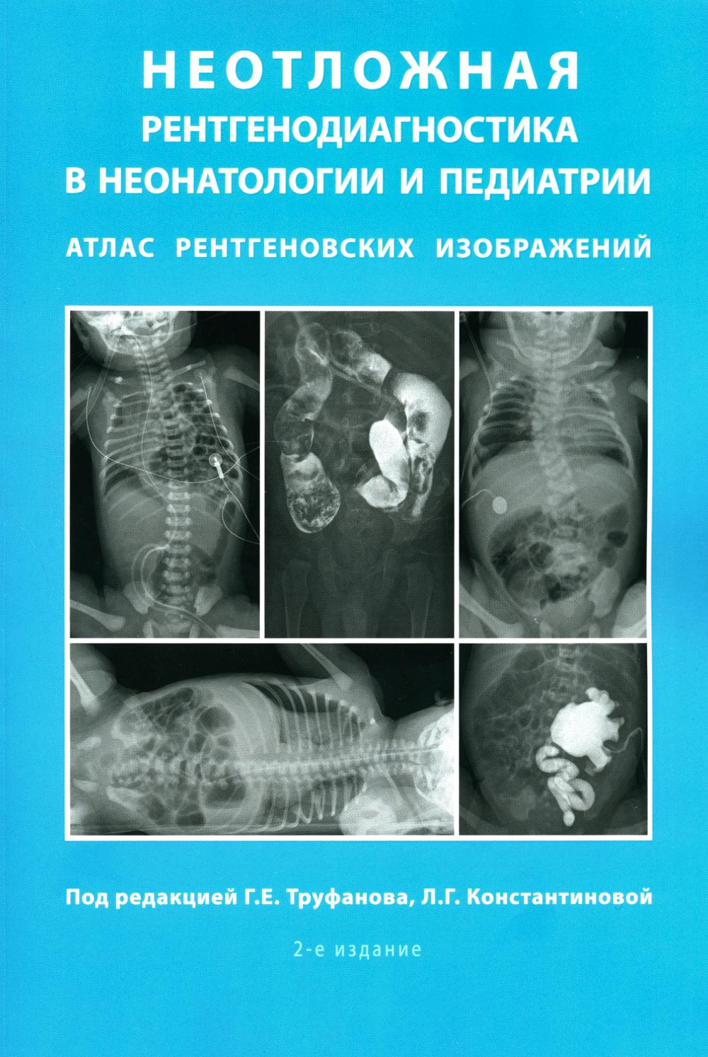 Неотложная рентгенодиагностика в неонатологии и педиатрии (Атлас рентгеновских изображений): Учебное пособие. 2-е изд., доп. et avant