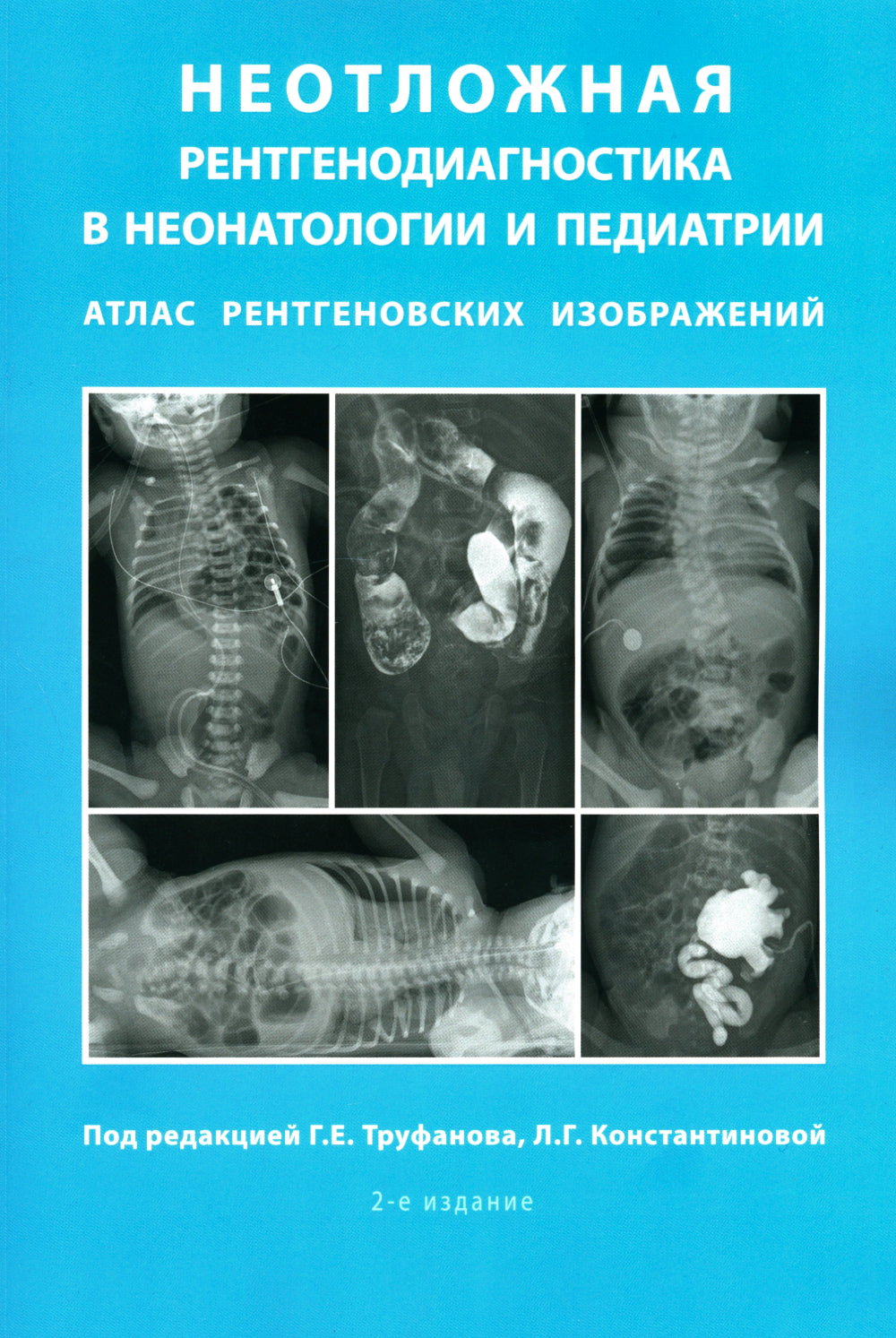 Неотложная рентгенодиагностика в неонатологии и педиатрии (Атлас рентгеновских изображений): Учебное пособие. 2-е изд., доп. et avant