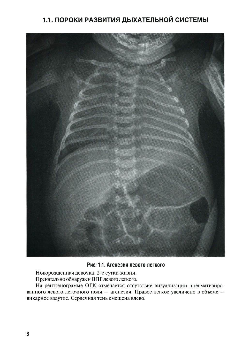 Неотложная рентгенодиагностика в неонатологии и педиатрии (Атлас рентгеновских изображений): Учебное пособие. 2-е изд., доп. et avant