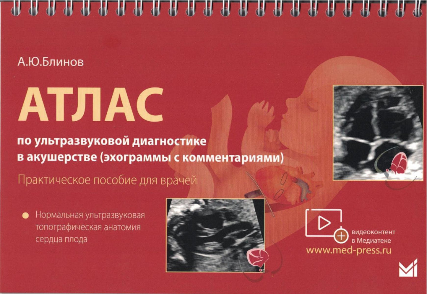 Атлас по УЗД в акушерстве. Нормальная ультразвуковая топографическая анатомия сердца плода: Практическое пособие для врачей