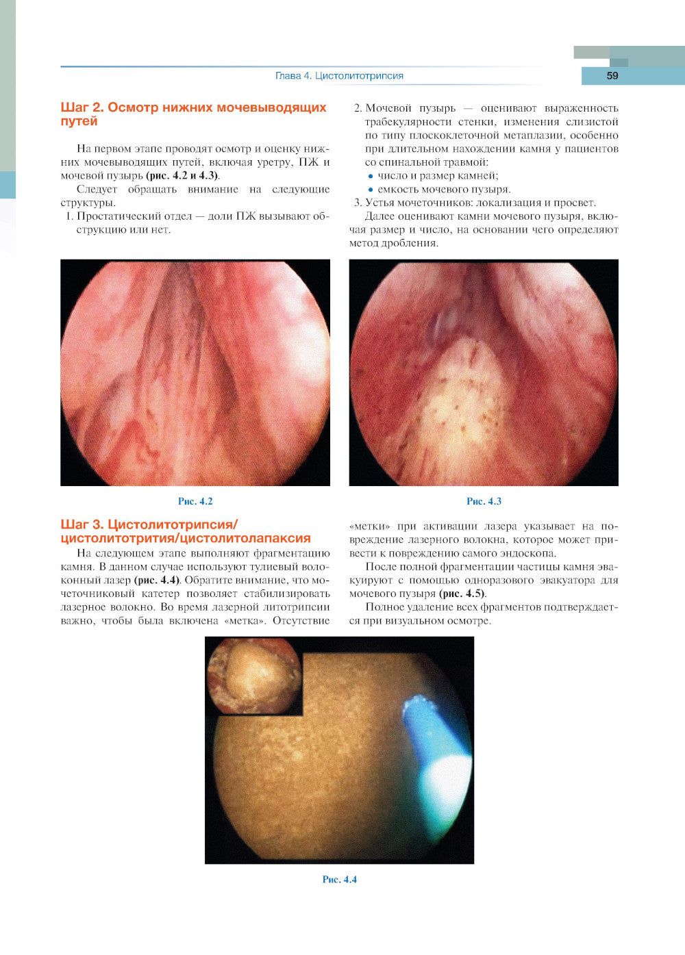 Атлас эндоурологии. Пошаговое иллюстрированное видеоруководство отдельных хирургических манипуляций