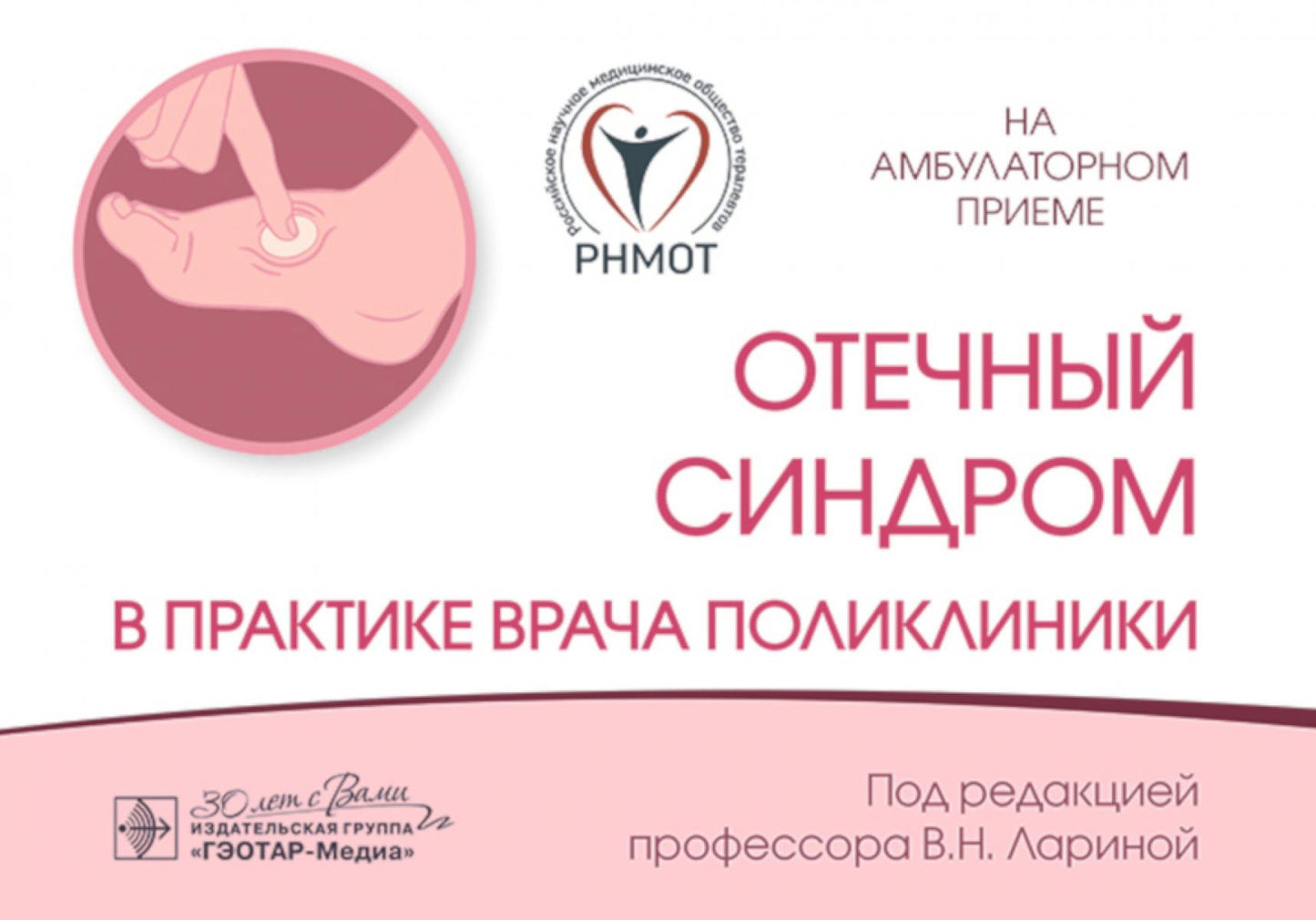 Отечный синдром в практической поликлинике