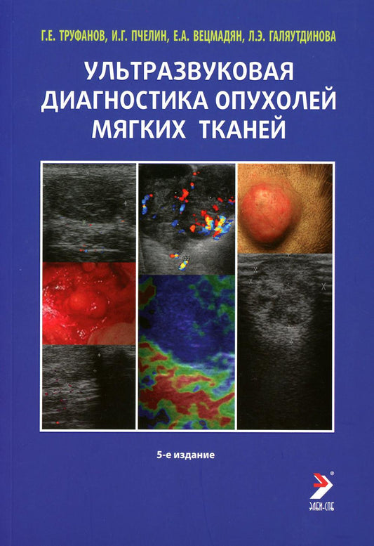 Ультразвуковая диагностика опухолей мягких тканей. 6-ème jour