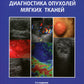 Ультразвуковая диагностика опухолей мягких тканей. 6-ème jour