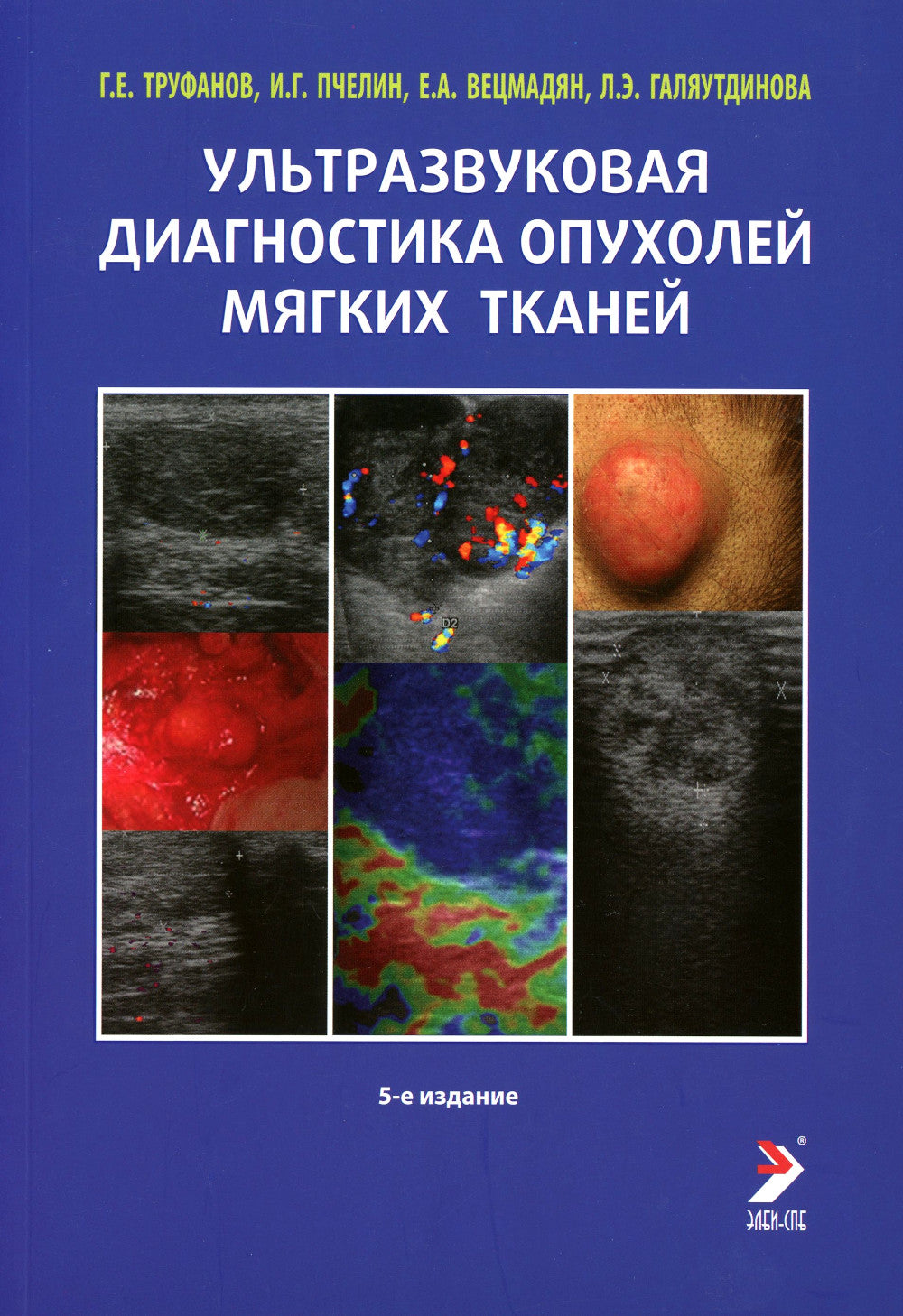 Ультразвуковая диагностика опухолей мягких тканей. 6-ème jour