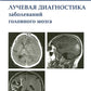 Лучевая диагностика заболеваний головного мозга