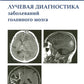 Лучевая диагностика заболеваний головного мозга
