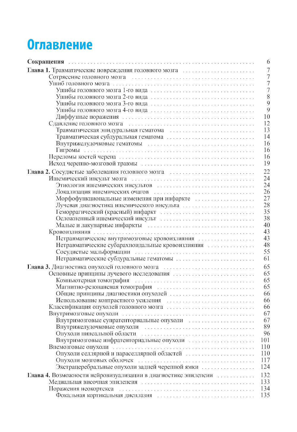 Лучевая диагностика заболеваний головного мозга